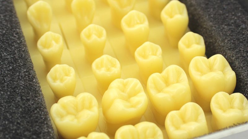 全瓷牙品牌选哪家？性价比高的四大考量因素